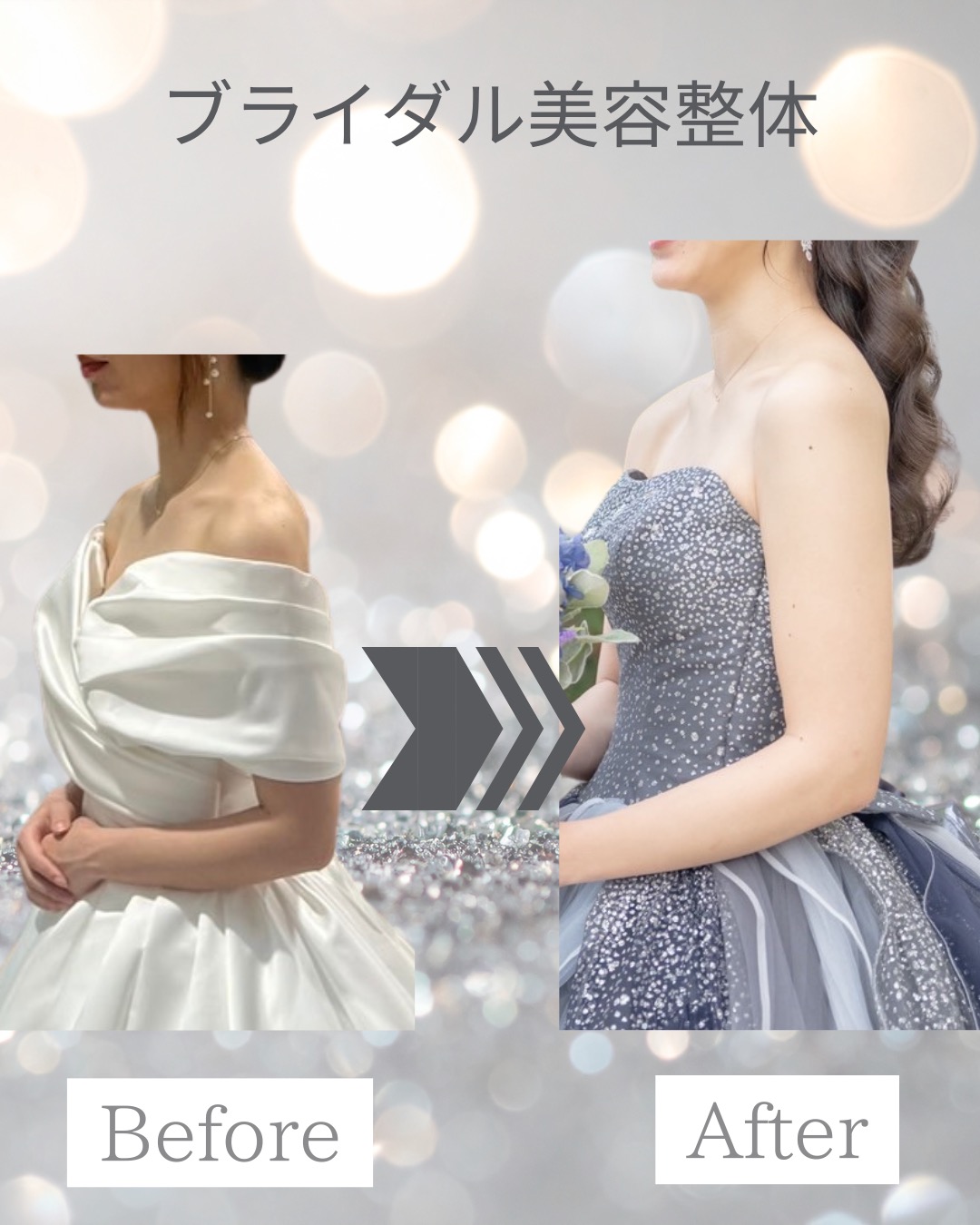 20代花嫁｜ブライダル美容整体