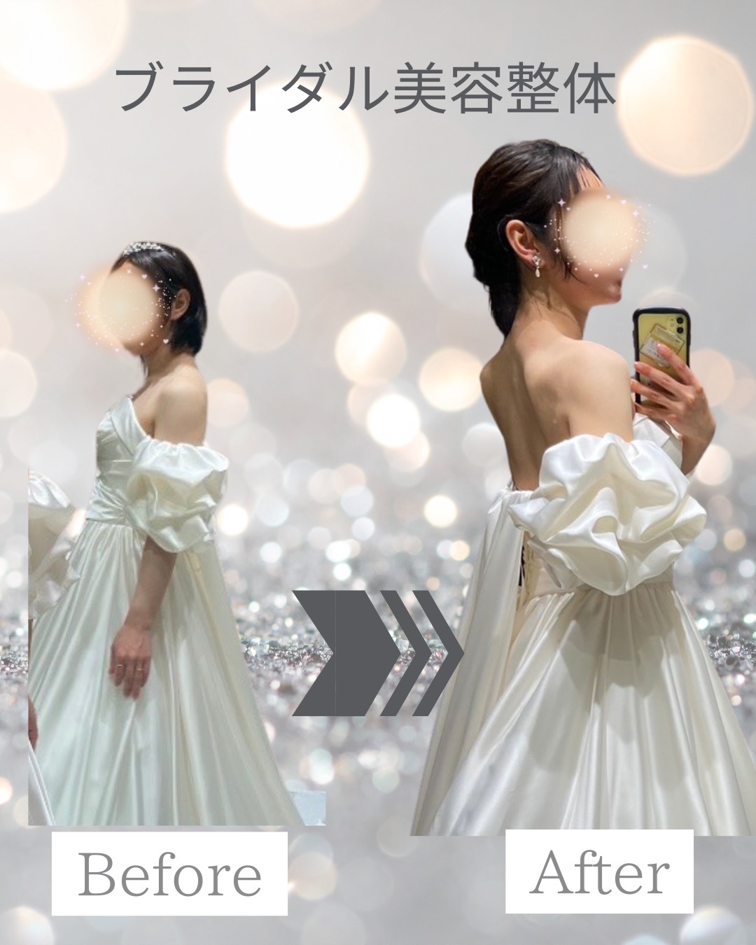 20代プレ花嫁/2ヶ月間サポート