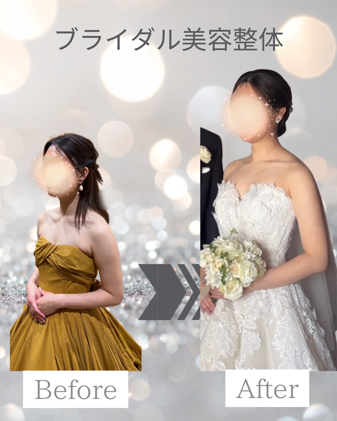 20代プレ花嫁様
