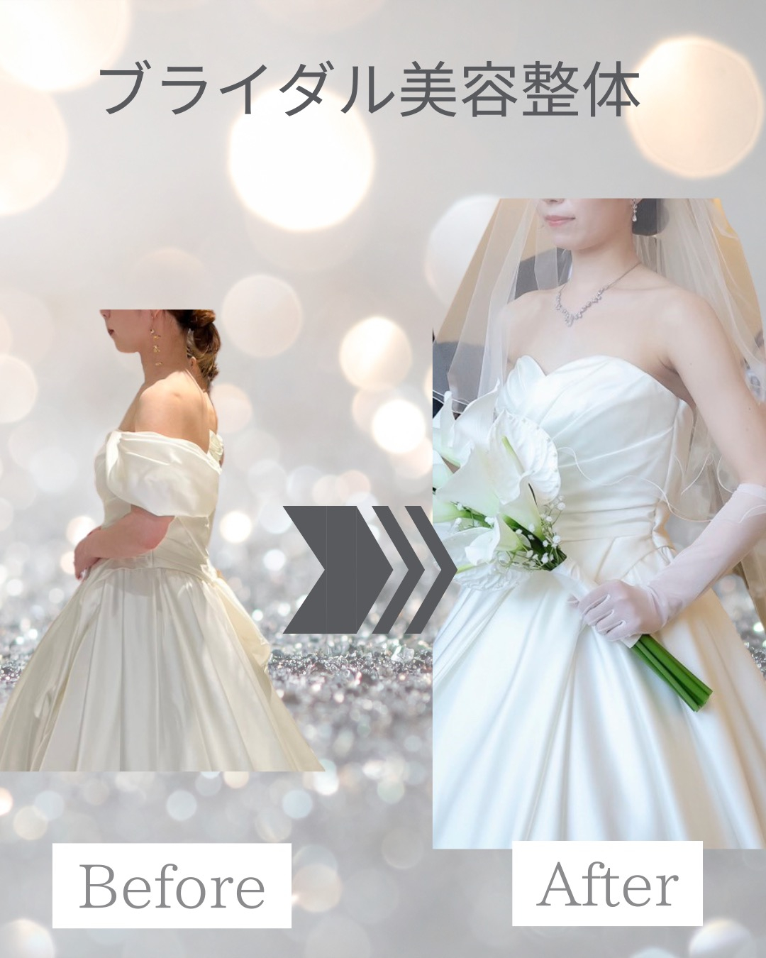 20代花嫁様 ブライダル美容整体　10ヶ月間サポート