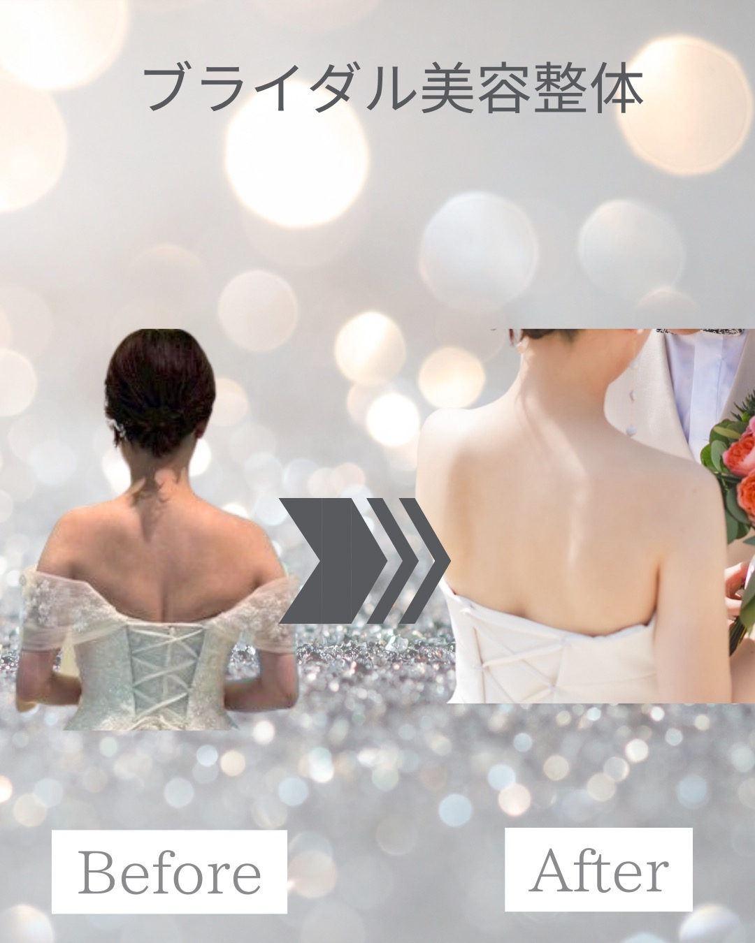 20代｜ブライダル美容整体