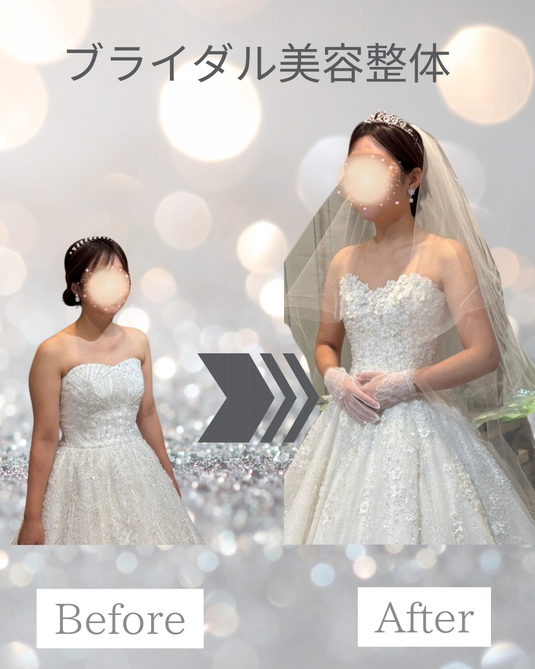 【30代プレ花嫁｜2ヶ月サポート】
