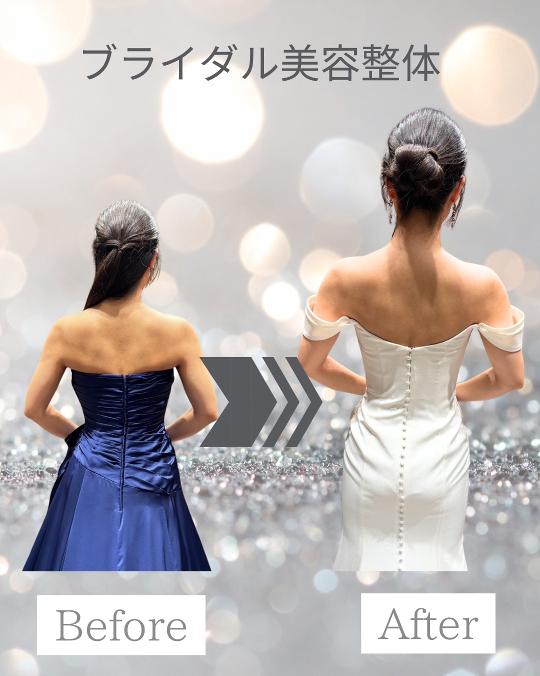 【20代プレ花嫁・挙式1ヶ月前の駆け込み】