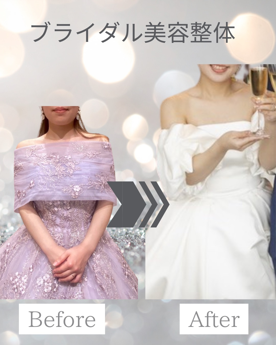 30代プレ花嫁 3ヶ月コース｜側弯対応ブライダル整体