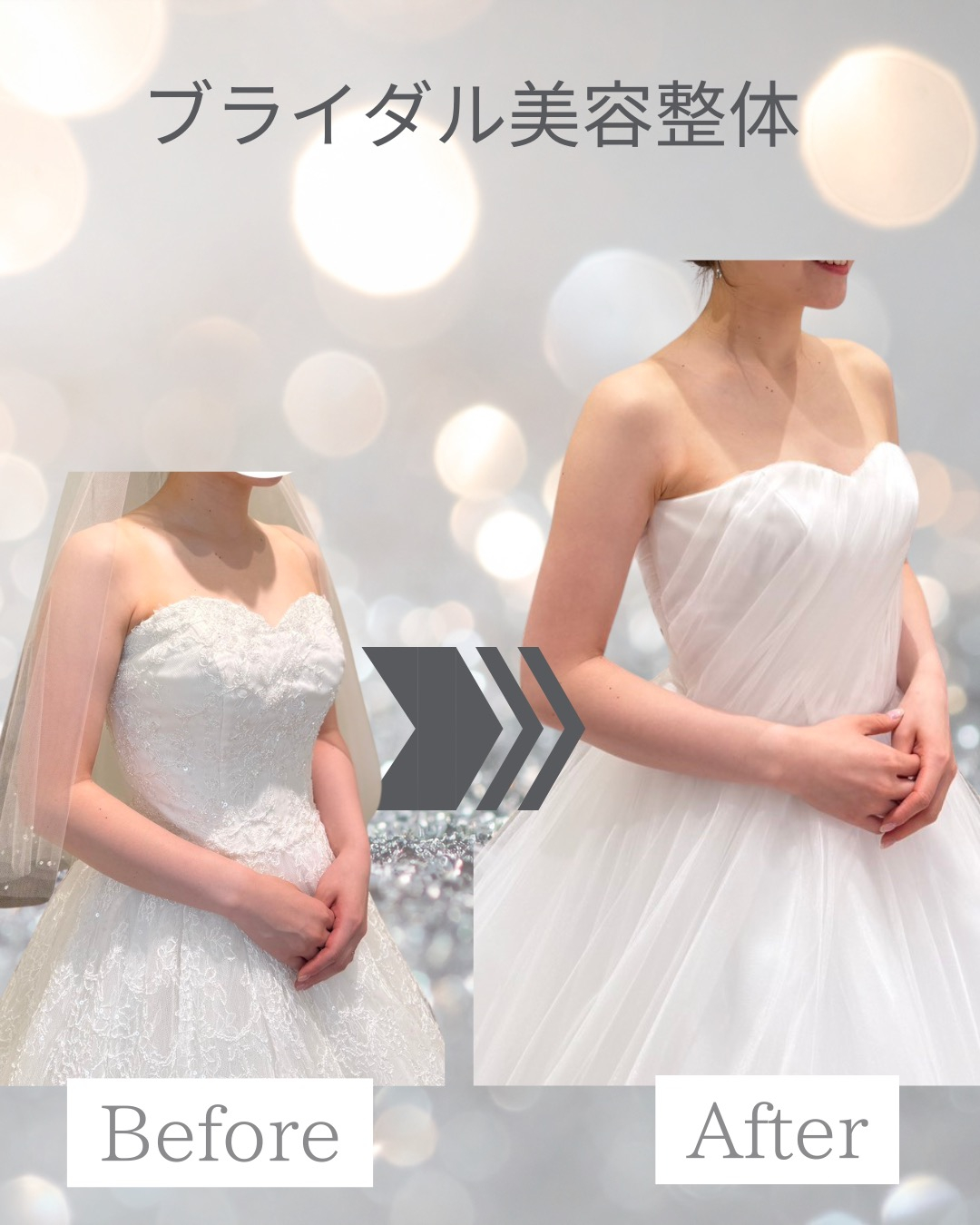 20代プレ花嫁 3ヶ月の奇跡