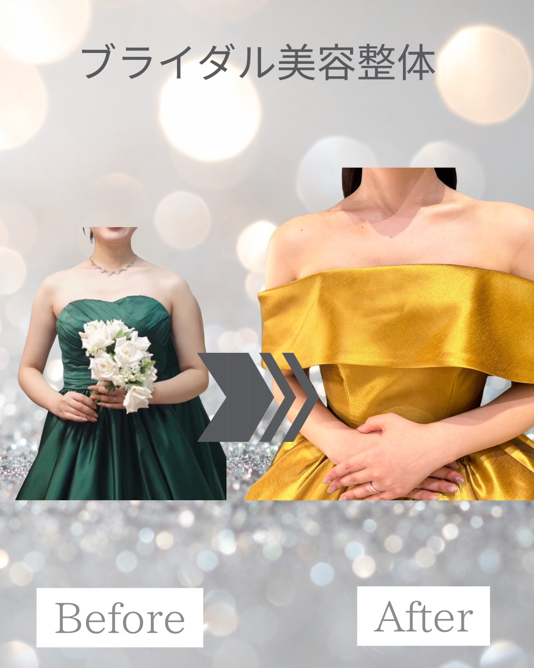 20代花嫁様 3ヶ月サポート