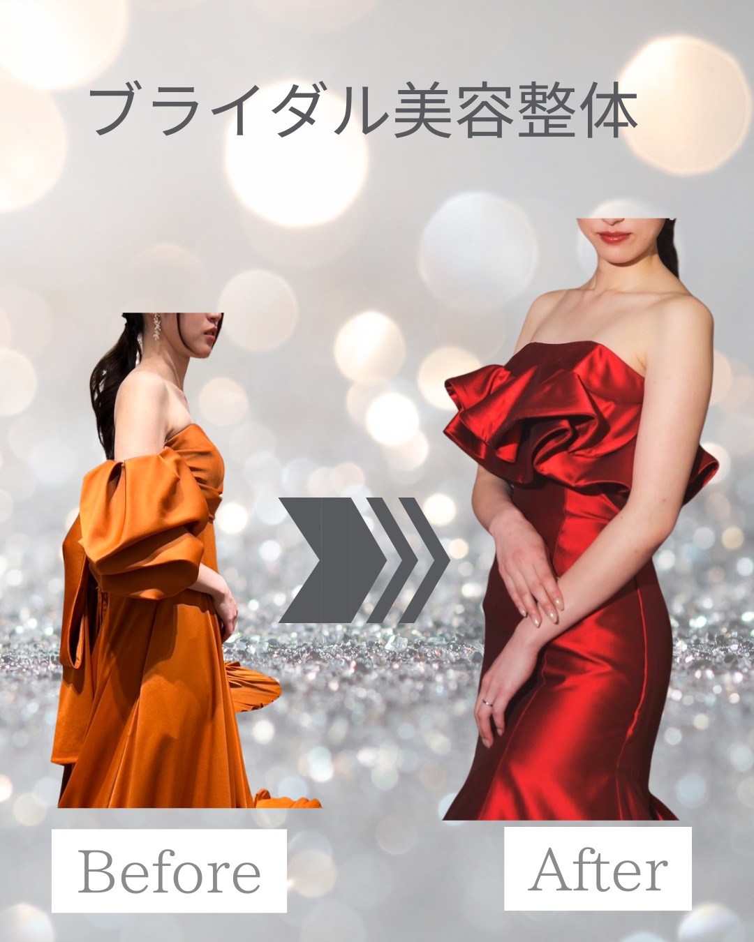 30代花嫁/ブライダル美容整体