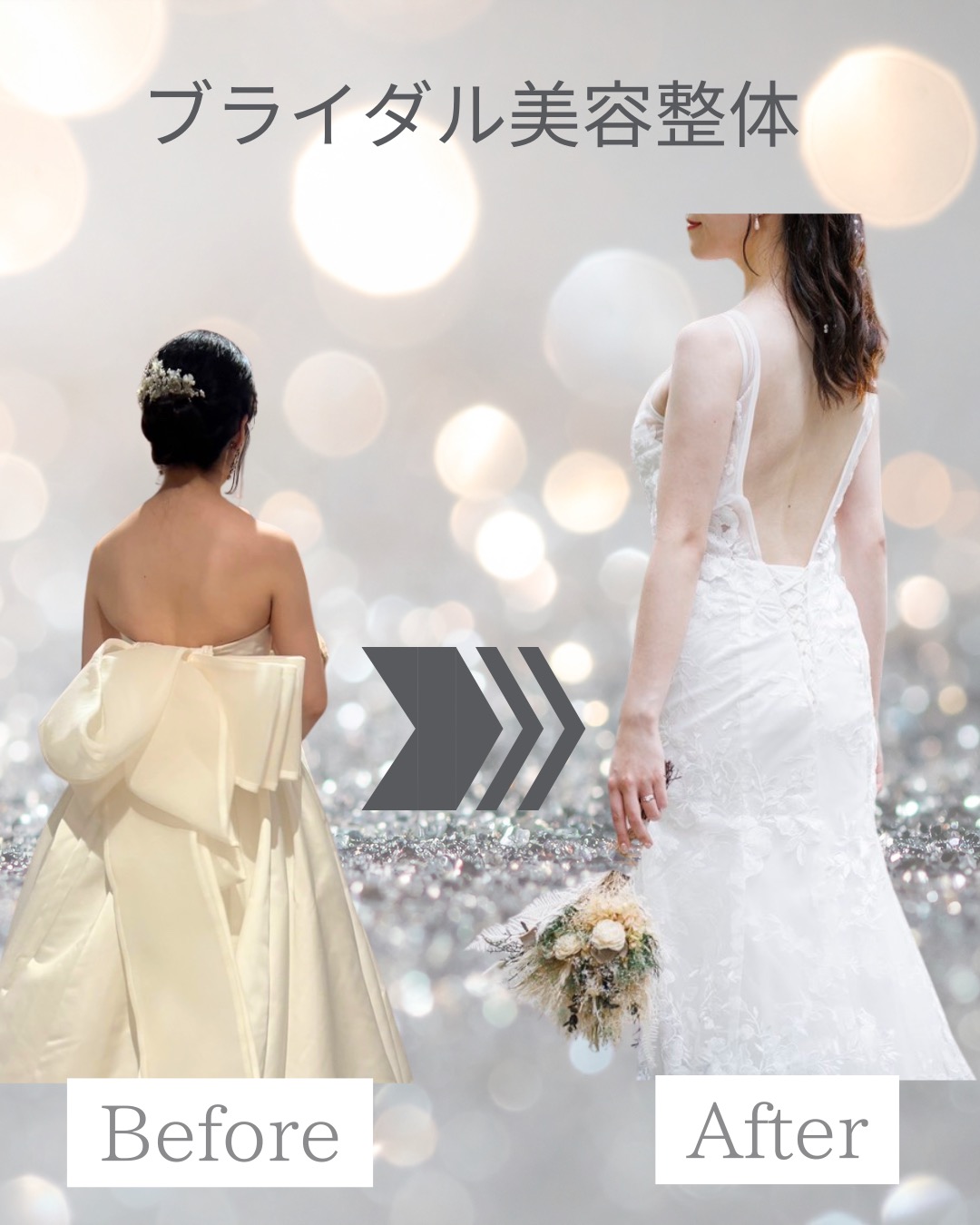 20代花嫁様｜ブライダル美容整体 5ヶ月サポート