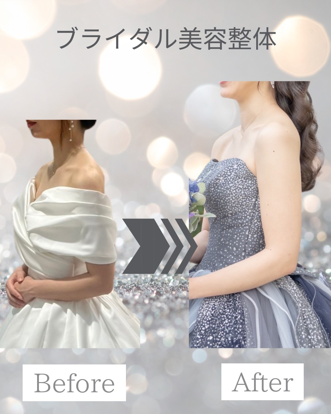20代花嫁|ブライダル美容整体
