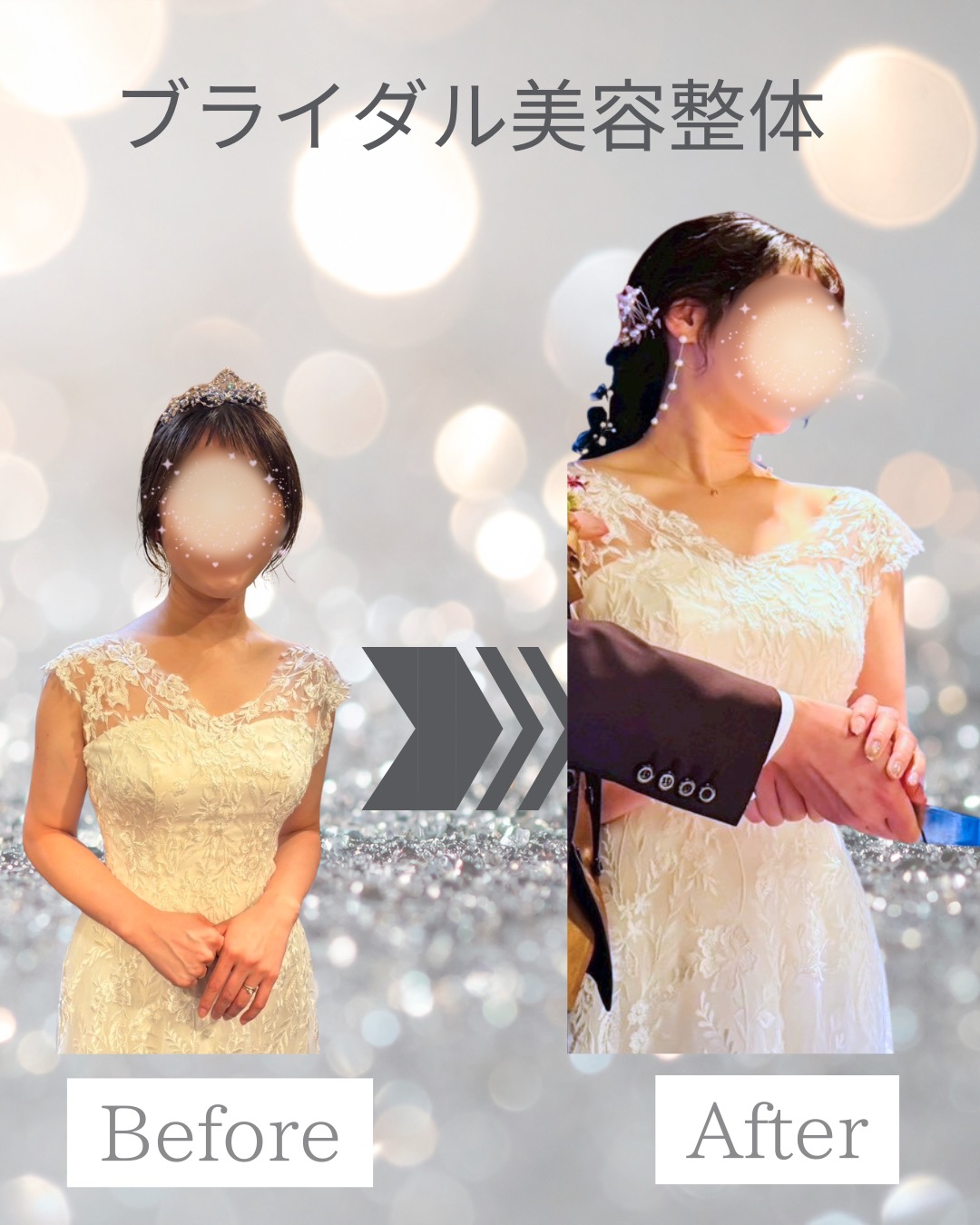 20代プレ花嫁 トータル【−8キロ】
