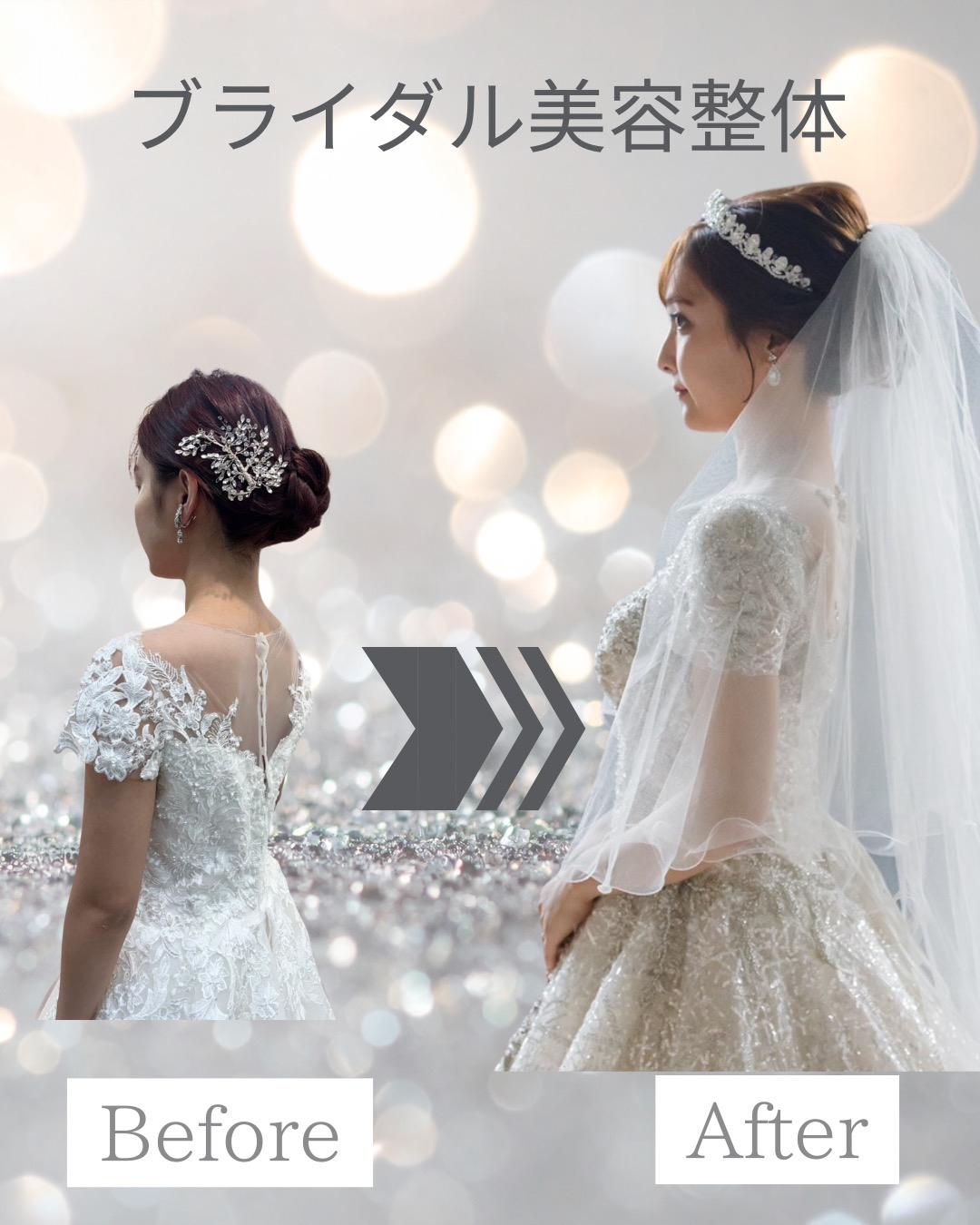 【20代花嫁様｜7カ月間サポート】